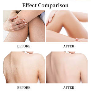 Lozione a Marchio Privato con AHA, Estratto di Ananas, Caffè, Mirtillo, Rosa, Avocado, Acido Kojico, Vitamina C, Anguria, Uva Ursina e Cocco - Product Image 6