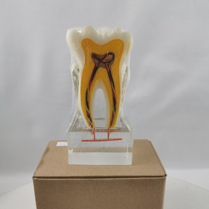 Modèle de nerf dentaire M7023 en résine, modèle anatomique pathologique pour l'enseignement des sciences médicales - Product Image 4