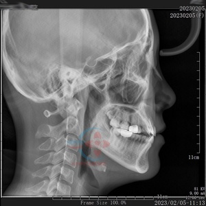 Appareil de radiographie panoramique dentaire Genoray PAPAYA Plus Pano Ceph d'occasion - Product Image 2