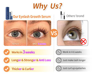 เซรั่มการเจริญเติบโตของขนตาแบบธรรมชาติที่มีประสิทธิภาพเพิ่มความยาวขนตาสินค้าตราเอกชนสินค้าใหม่ - Product Image 4