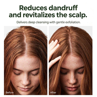 Shampooing Exfoliant Apaisant Anti-Pelliculaire Personnalisé à la Biotine, Romarin et Menthe pour un Nettoyage en Profondeur et un Volume Rafraîchissant des Cheveux