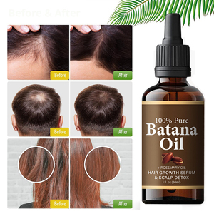 <span class=keywords><strong>Huile</strong></span> de Batana 100% Pure, Naturelle et Biologique pour Renforcer les Racines <span class=keywords><strong>des</strong></span> <span class=keywords><strong>Cheveux</strong></span>, Stimuler <span class=keywords><strong>la</strong></span> Croissance et l'Épaisseur - Product Image 6