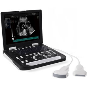 Escáner de Ultrasonido <span class=keywords><strong>Digital</strong></span> en Blanco y Negro con Certificación CE de MT Medical, Apto para Humanos y Veterinarios. - Product Image 2