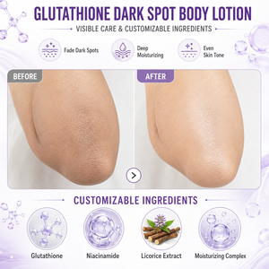 Lotion corporelle blanchissante puissante au glutathion, éliminateur de taches brunes, crème éclaircissante pour les genoux, les coudes, les parties intimes et les aisselles - Product Image 2