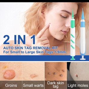 Skin Tag <strong>Removal</strong> Silicone Bands Elastic Groin <strong>Wart</strong> Mole <strong>Removing</strong> Rubber Ring Kit With Alcohol Pad - Product Image 2