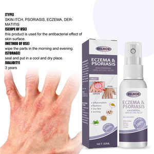Eelhoe Spray de 30 ml para <span class=keywords><strong>Eczema</strong></span> y Psoriasis, Inflamación de la Piel, Enrojecimiento, Picazón, Tratamiento Líquido para Psoriasis, <span class=keywords><strong>Eczema</strong></span> y Dermatitis - Product Image 2
