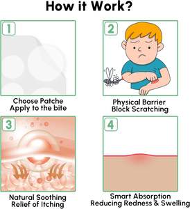 Parches para Aliviar la Picazón de Picaduras de Insectos para Niños - 60 Unidades, Esenciales para Viajes y Campamentos, Adhesivos para Aliviar la Picazón de <span class=keywords><strong>Mosquitos</strong></span> e Insectos - Product Image 6