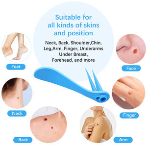 ELAIMEI 2 in 1 Micro <strong>Skin</strong> <strong>Tag</strong> Remover Kit Beauty Tools Mole and Wart <strong>Removal</strong> Pen for Small to Large <strong>Skin</strong> <strong>Tag</strong> 1-9mm - Product Image 3