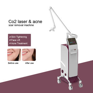 10600nm <span class=keywords><strong>Co2</strong></span> láser <span class=keywords><strong>fraccional</strong></span> eliminación de cicatrices de acné profesional <span class=keywords><strong>fraccional</strong></span> <span class=keywords><strong>Co2</strong></span> láser máquina de ajuste vaginal - Product Image 2