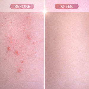 Sérum Huile Roll-On Cyperus Rotundus Marque Blanche Post-Épilation Inhibe la Repousse Bio Jojoba <span class=keywords><strong>Visage</strong></span> Corps OEM - Product Image 6