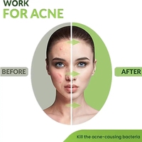 Poudre de Qasil en Gros, Livraison Gratuite, Crème Visage et Masque Qasil Somalien en Vrac pour Soins de la Peau