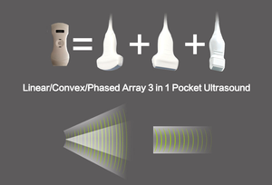 192 Element Phased Array cardiaco, lineare e convesso 3 in 1 Scanner ad ultrasuoni Color Doppler portatile - Product Image 3