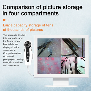เครื่องวิเคราะห์รูขุมขนและหนังศีรษะ HD 2025เครื่องวิเคราะห์เส้นผมเครื่องวิเคราะห์หนังศีรษะสำหรับสปาผม - Product Image 5