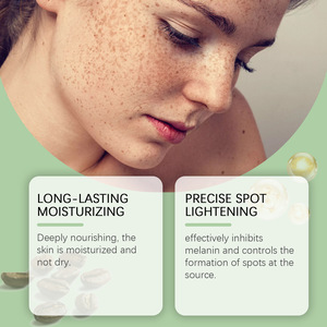 Crema OUHOE para Eliminar Manchas, Melasma, Imperfecciones, Crema Blanqueadora Fuerte para Eliminar Pecas y Corrector Facial - Product Image 4