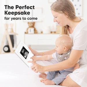 Marco de escaneo de bebé Marco de ultrasonido Anuncio de bebé Embarazo Reveal Marco de imagen de ultrasonido - Product Image 6