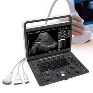 جهاز سونوسكيب E1 للتصوير بالموجات فوق الصوتية الملونة مع مسبار تي إي إي للأطفال - Product Image 5