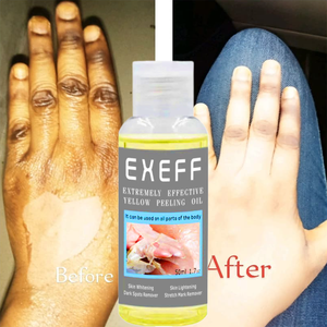 Nhãn Hiệu Riêng Không Có Nhãn Lột Dầu Làm Trắng Vàng Da Đen Lột Sáng Cơ Thể Khuôn Mặt - Product Image 1