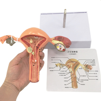 Modelo de Útero Femenino para Patología, Anatomía Médica, para Médicos y Estudiantes