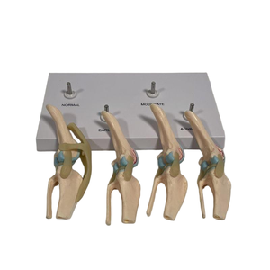 Modelo Comparativo de Articulación de <span class=keywords><strong>Rodilla</strong></span> Canina de Cuatro Etapas, Modelo de Demostración de Lesiones Articulares Normales, Tempranas, Moderadas y Avanzadas - Product Image 3