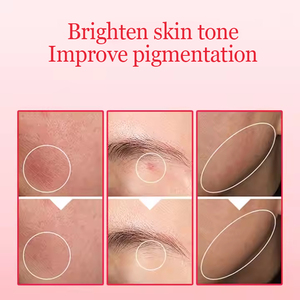 Siero Viso alla Niacinamide per Schiarire la Pelle, 10% Niacinamide + 4% Acido Tranexamico, Correttore Macchie Scure, Siero Illuminante - Product Image 4