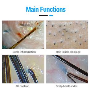 HD 15 Zoll Bildschirm Haarfollikel Kopfhaut Scanner Detektor Haarana lysator Haut Kopfhaut Haar analyze gerät - Product Image 4
