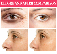 6 Pièces Masques Patchs Hydrogel au Collagène Sous les Yeux Marque Blanche pour les Cernes