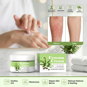 Crema Herbal <span class=keywords><strong>para</strong></span> Eczema de Marca Privada, Hidratante, Nutritiva <span class=keywords><strong>para</strong></span> la Piel, Tratamiento <span class=keywords><strong>para</strong></span> <span class=keywords><strong>Dermatitis</strong></span> y Psoriasis, Sin Esteroides, Calmante y Anti-Picazón - Product Image 1