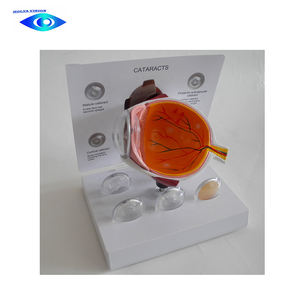 Modelo de ojo humano de catarraco para ciencia médica, modelo de ojo anatómica - Product Image 5