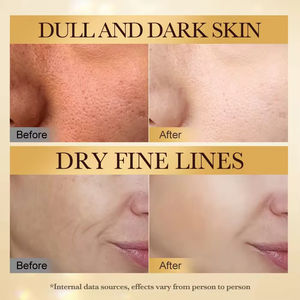 Set Regalo 6 Pezzi OEM all'Ingrosso per la Cura della Pelle del Viso con Veleno d'Api Naturale, Retinolo, Nicotinamide e Acido Ialuronico Idratante e Riparatore - Product Image 4