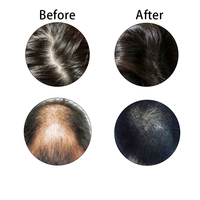 Pabrik OEM/ODM Alami Organik Kustom Vegan Anti-Rontok Anti-Ketombe Menutrisi Menyegarkan Memperbaiki Rambut Teh Mint Gardenia