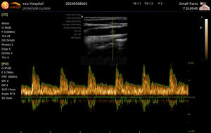 Laptop Full Digital Ultrasound Scanners Ultrassom Portátil Doppler Colorido - Product Image 5