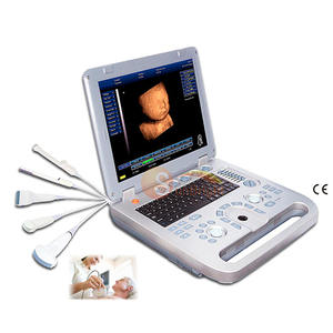 Instrument à ultrasons 3D pour ordinateur portable médical à écran de 15 pouces pour humain avec sonde OB/GYN/vasculaire/urologie - Product Image 1