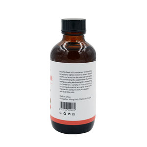 100% puro prensado en frío y virgen orgánico aceite de semilla de <span class=keywords><strong>rosa</strong></span> mosqueta para <span class=keywords><strong>la</strong></span> cara y de <span class=keywords><strong>la</strong></span> piel - Product Image 4