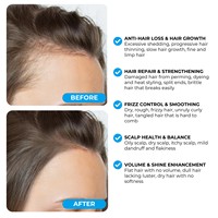 Minyak Rambut Elixir Pertumbuhan Rambut Rosemary OEM, Perawatan Kulit Kepala Penguat Rambut dengan Peppermint, Keratin, Kolagen, Minyak Argan, dan Minyak Tea Tree