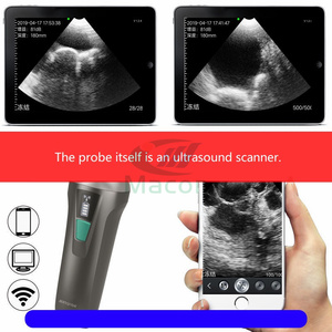 MC100vet - Escáner de Ultrasonido Veterinario Inalámbrico Portátil de Alta Rentabilidad para Cerdos y Cabras - Product Image 3