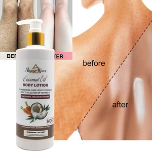 Crème blanchissante rapide pour les peaux foncées Kojic Sen Lotion corporelle hydratante et éclaircissante Soins de la peau pour un teint impeccable - Product Image 2