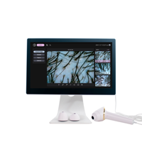 Détecteur de cuir chevelu WiFi Trichoscope Factory avec analyse et impression de rapports PDF pour machine de salon de beauté