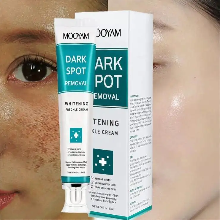 Whitening Dark Spot Removal Cream Freckle Soothe the Skin Moisturizes Brightens the Complexion 30g MOOYAM Whitening Cream