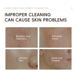 <span class=keywords><strong>Gel</strong></span> <span class=keywords><strong>nettoyant</strong></span> à l'essence d'escargot LAIKOU KOREA 50g, acide hyaluronique, crème anti-rides, éclaircissant, <span class=keywords><strong>hydratant</strong></span>, <span class=keywords><strong>nettoyant</strong></span> <span class=keywords><strong>visage</strong></span> - Product Image 3