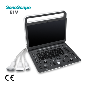 Ecógrafo Veterinario Portátil SonoScape E1V <span class=keywords><strong>con</strong></span> Imágenes en B/N para Diagnóstico <span class=keywords><strong>de</strong></span> Animales Pequeños y Grandes - Product Image 1