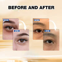 Patchs pour le contour des yeux : atténuent les cernes, lisent les ridules, illuminent, liftent et raffermissent