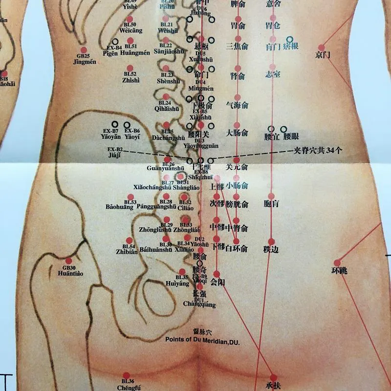 중국 의료 침술 차트 포인트 인체 경점 자오선지도