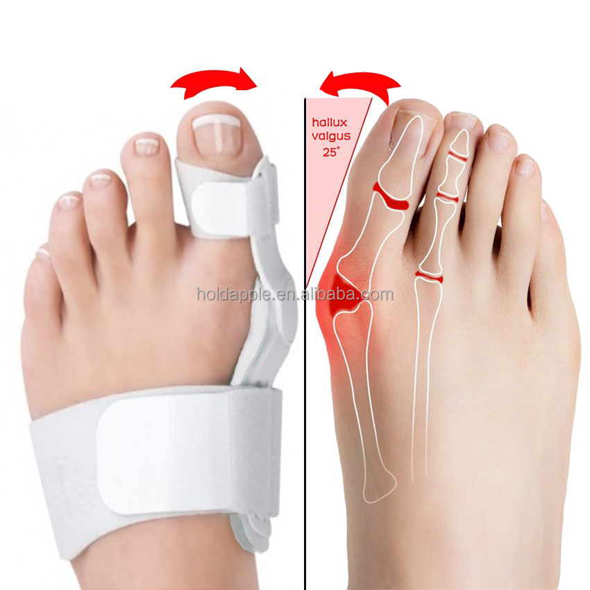 大脚趾邦尼夹板拇趾外翻矫形器鞋类矫直器矫正器,用于鞋脚疼痛缓解