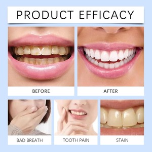 Disposable Wipe Oral Finger Brush Up Disposable Finger Toothbrush Adult <b>Teeth</b> Whitening Strips Gentle <b>Teeth</b> <b>Cleaning</b> <b>Tools</b> - Product Image 3