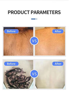 Appareil de réparation post-opératoire rapide par refroidissement à air froid de type rouleau mobile pour la réduction des œdèmes laser - Product Image 6