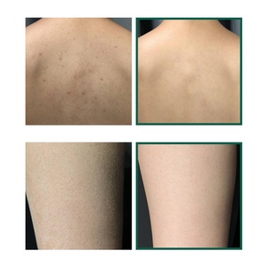 Loción Corporal Orgánica al por Mayor para Hidratar, Iluminar, Blanquear, Calmar, Suavizar y Exfoliar con AHA y BHA - Product Image 6