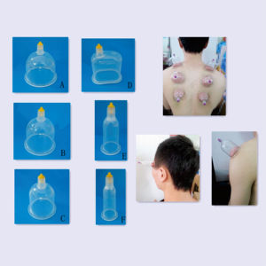 Alat bekam sekali pakai grosir pabrik tepercaya untuk ukuran akupunktur tubuh-D - Product Image 4