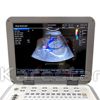 Échographe Doppler couleur portable K-C303 le plus vendu pour cliniques vétérinaires et diagnostiques