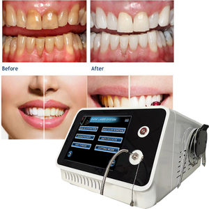 Laser trattamento dentale dei tessuti molli sbiancamento dei denti cura orale doppia onda 980nm 1470nm modalità di taglio diodo fibra ottica - Product Image 3