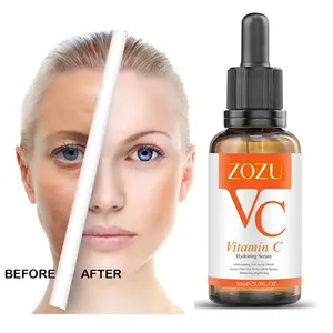 Private Label Brand Vitamin C Serum Kojic Acid Serum Vc Cream Skin Care Remove Dark Spots Whitening Face Secrum